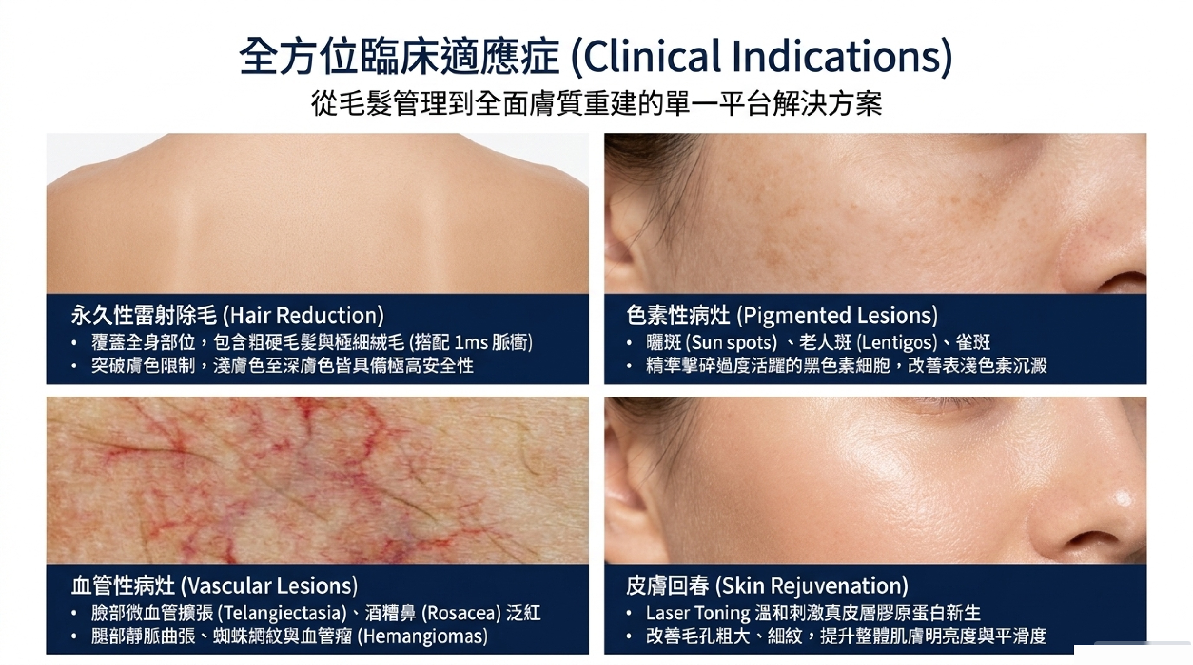 Clarity II 全方位臨床適應症:除毛、淨斑、血管病灶、皮膚回春