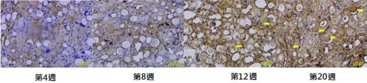 AestheFill 漸進式刺激真皮層膠原蛋白增生的細胞機轉