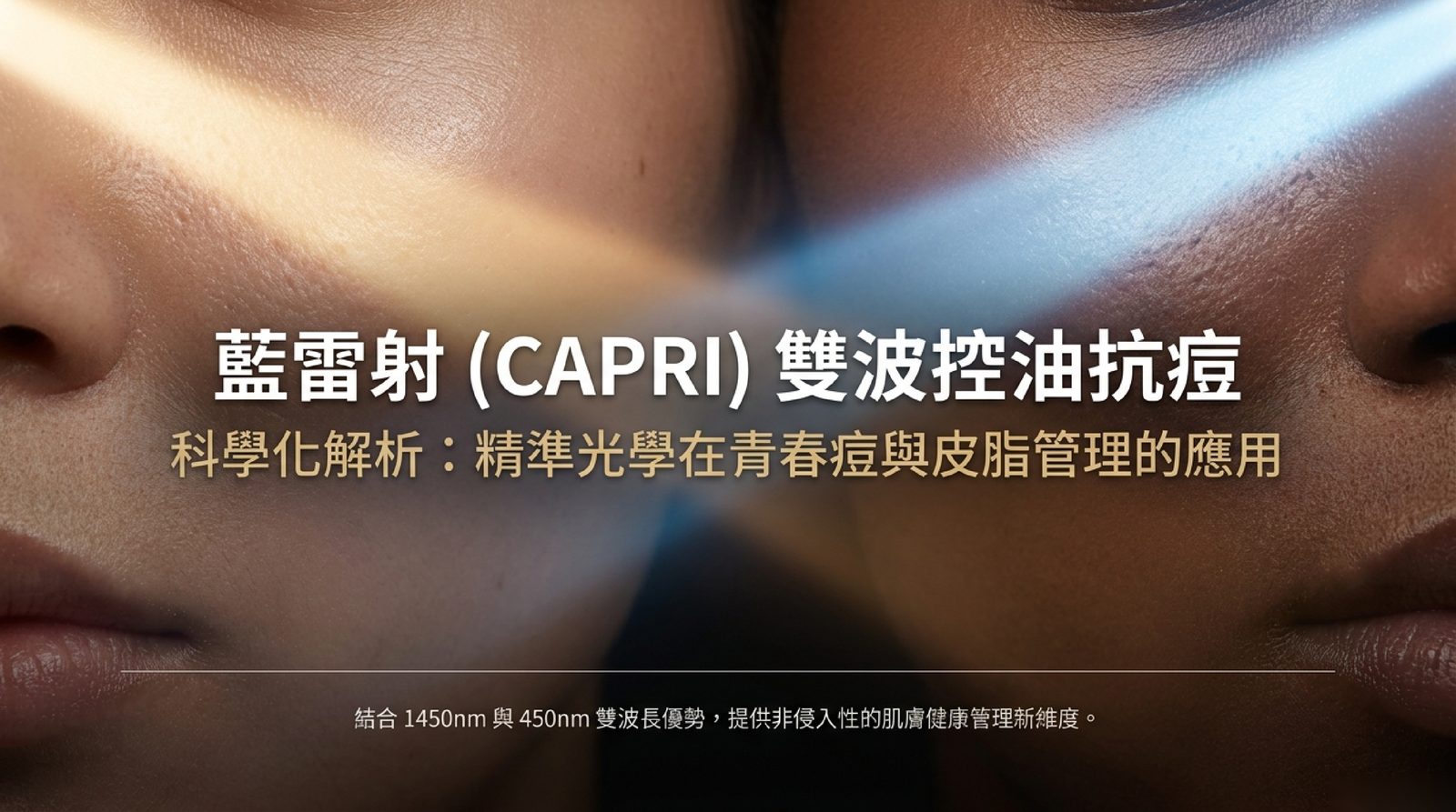 藍雷射(CAPRI)以 1450nm 雷射與 450nm 藍光兩種波長處理出油與發炎型痘痘