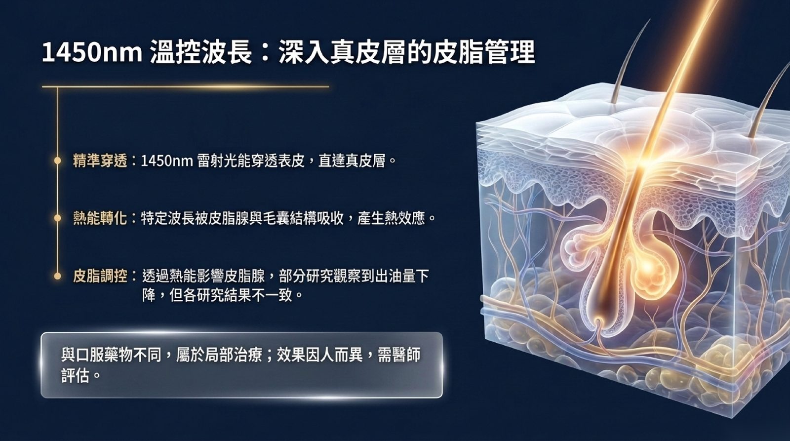 1450nm 雷射穿透表皮到真皮層,以熱能影響皮脂腺活性的示意圖