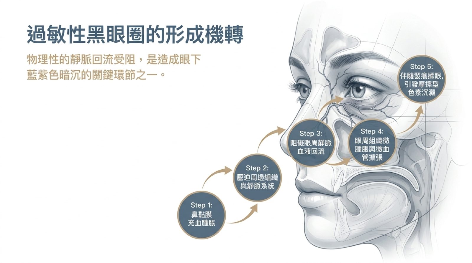 過敏性黑眼圈的形成機轉:鼻黏膜充血腫脹,影響眼周靜脈回流,眼周微腫脹與微血管擴張,再加上揉眼造成的摩擦型色素沉澱
