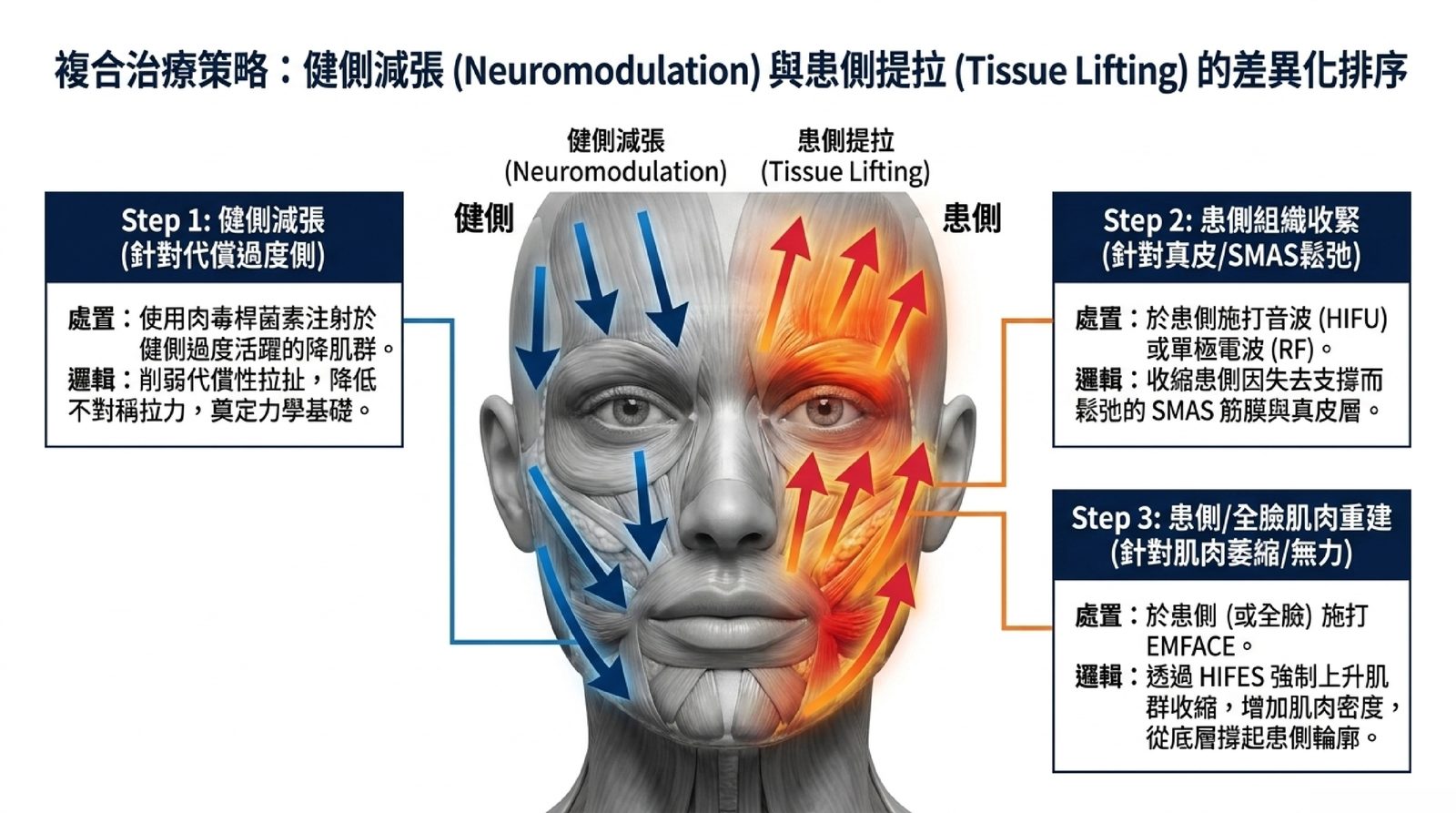複合治療策略示意:健側以肉毒減張降低代償拉力,患側以音波與電波收緊組織、再以 EMFACE 重建肌肉密度,兩側方向相反