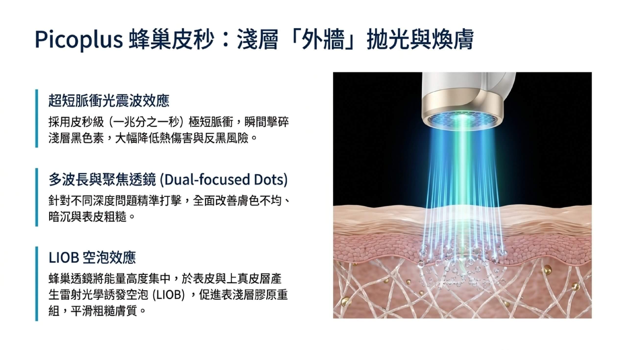 Picoplus 蜂巢皮秒:450ps 極短脈衝、高尖峰功率與蜂巢透鏡 MLA 的淺層外牆拋光