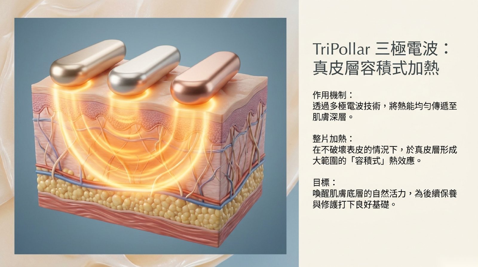 TriPollar 三極電波:三個電極輪流導電,在不破壞表皮的情況下把真皮整片加熱
