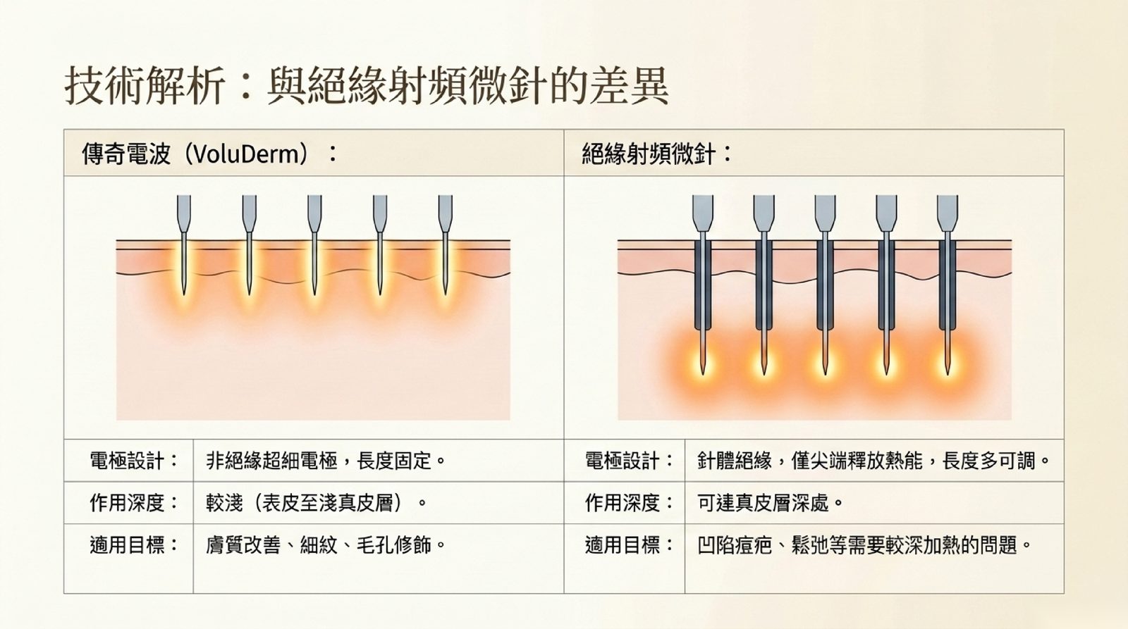 傳奇電波 VoluDerm 非絕緣超細電極與絕緣射頻微針的差異:電極設計、作用深度與適用目標