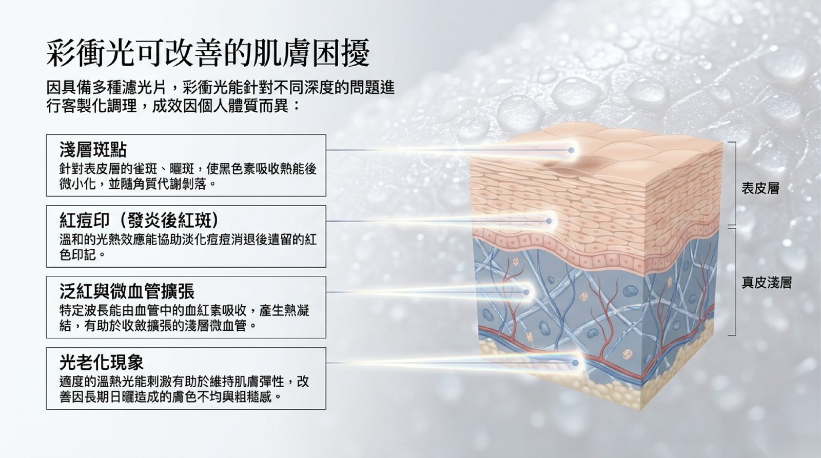 彩衝光可改善的肌膚困擾:淺層斑點、紅痘印、泛紅與微血管擴張、光老化,依表皮與真皮淺層深度示意