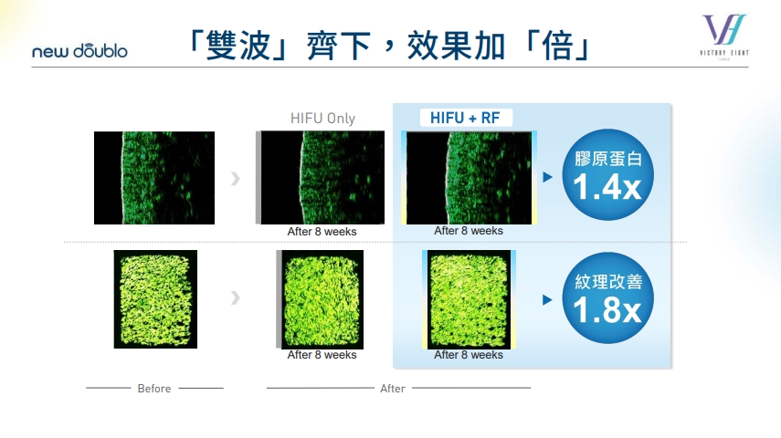 新倍提顯微 2