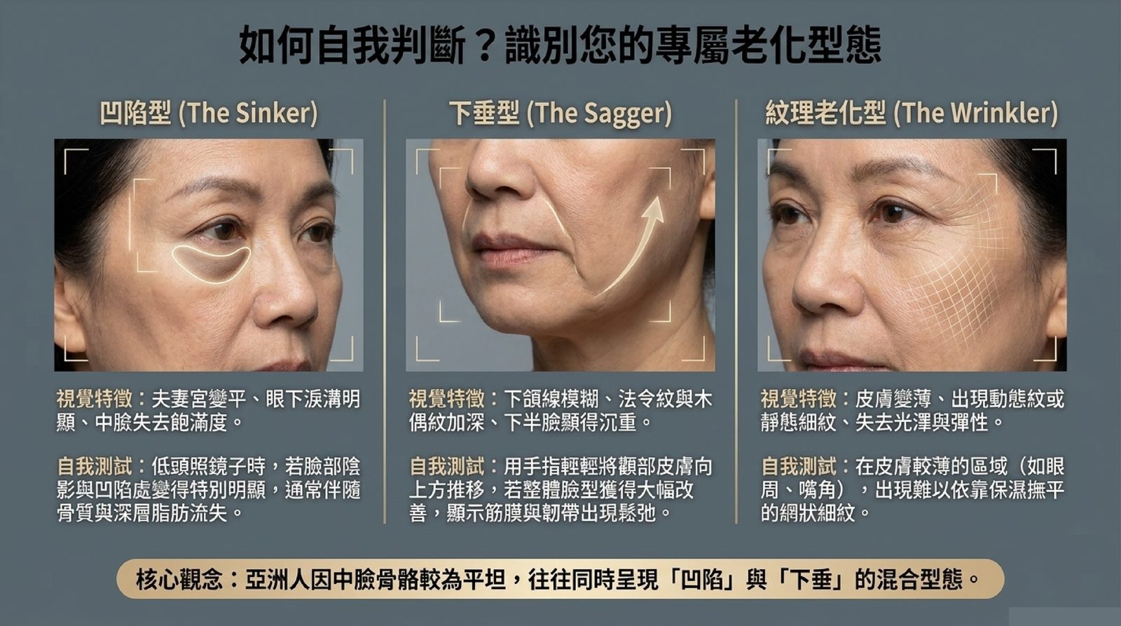 臉部老化自我判斷:凹陷型、下垂型、紋理老化型的視覺特徵與自我測試方式