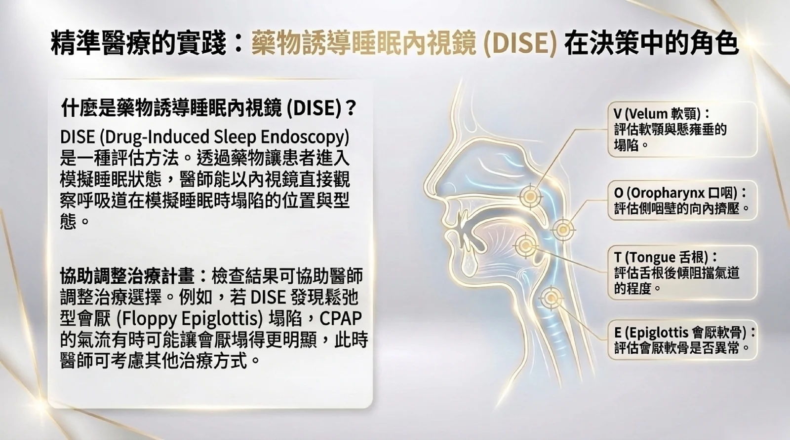 藥物誘導睡眠內視鏡(DISE)在治療決策中的角色:以藥物模擬睡眠,用內視鏡觀察軟顎、口咽、舌根、會厭四個部位的塌陷型態,檢查結果協助醫師調整治療選擇