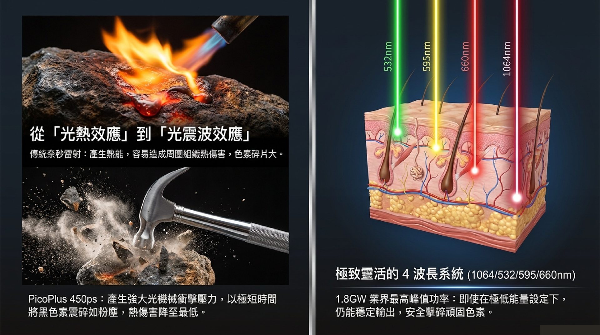 PicoPlus 皮秒雷射的光震波效應與 532/595/660/1064nm 四波長系統技術原理