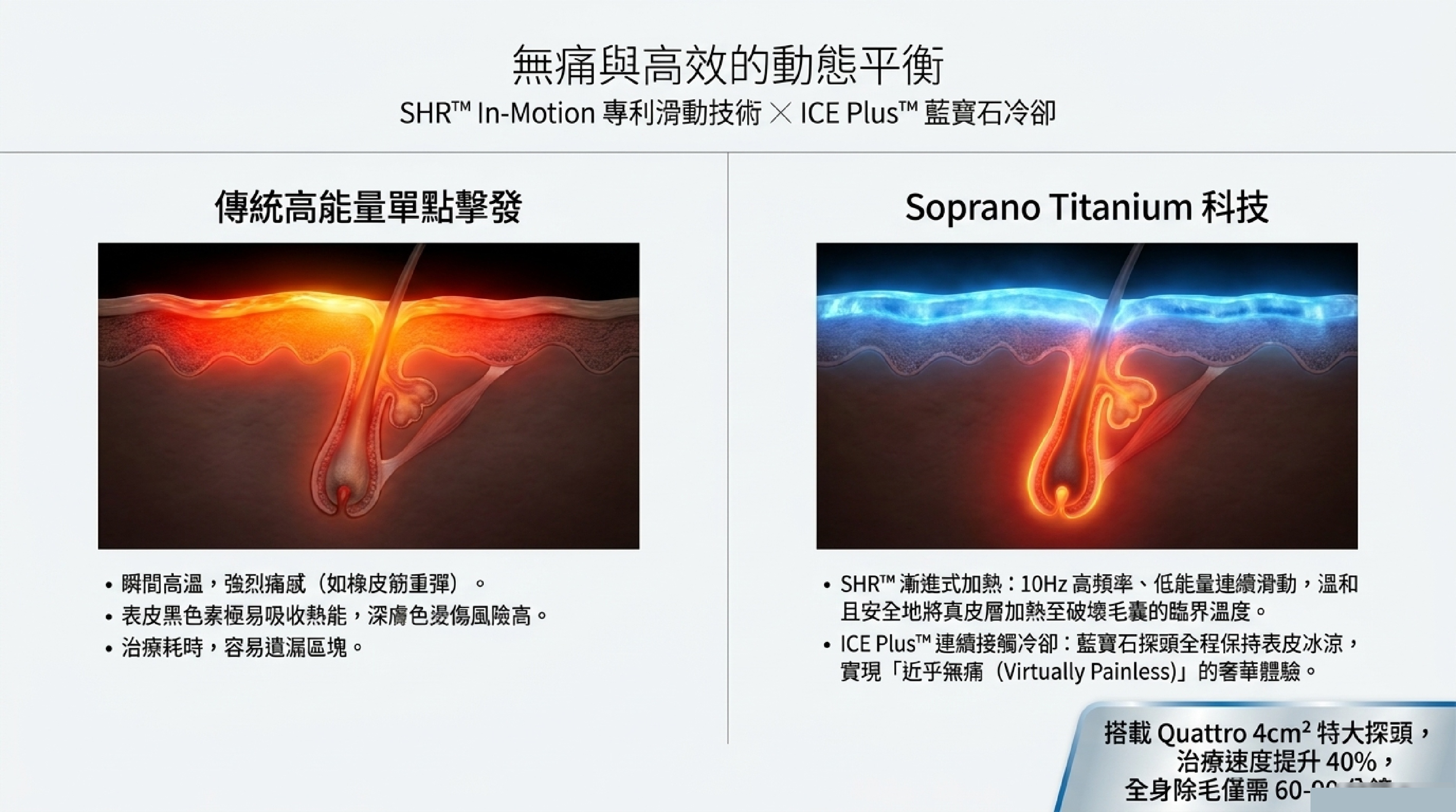 SHR In-Motion 滑動技術與 ICE Plus 藍寶石冷卻系統:將傳統高能量單擊轉為低痛感的漸進式毛囊加熱
