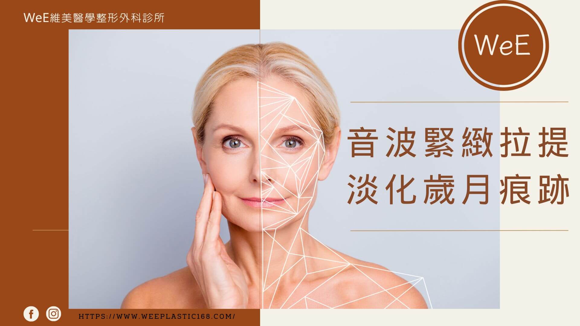 音波拉提有效嗎?多久撐多久