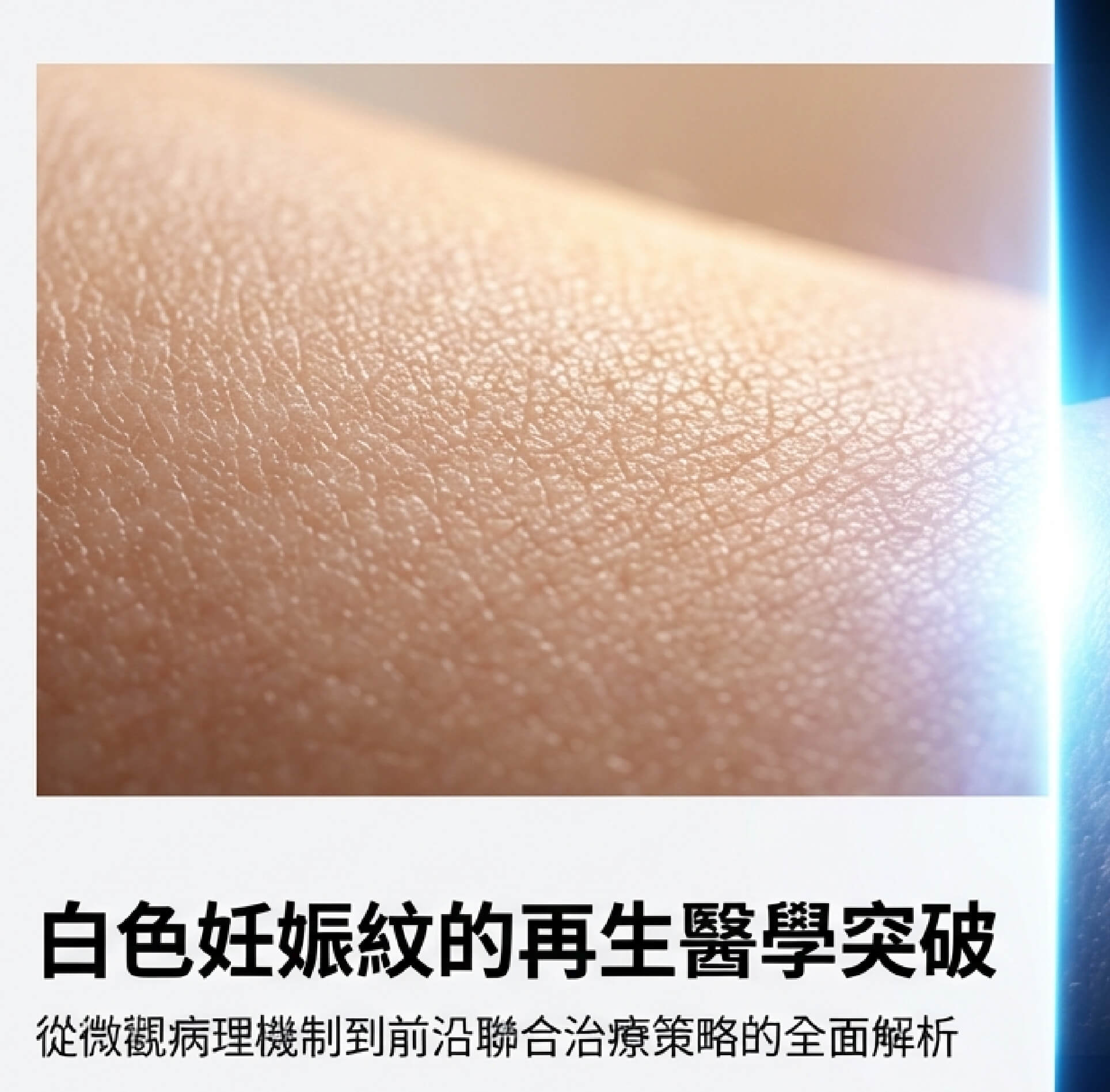 白色妊娠紋治療:再生醫學與先進光電技術的綜合分析與真皮層 3D 結構重建