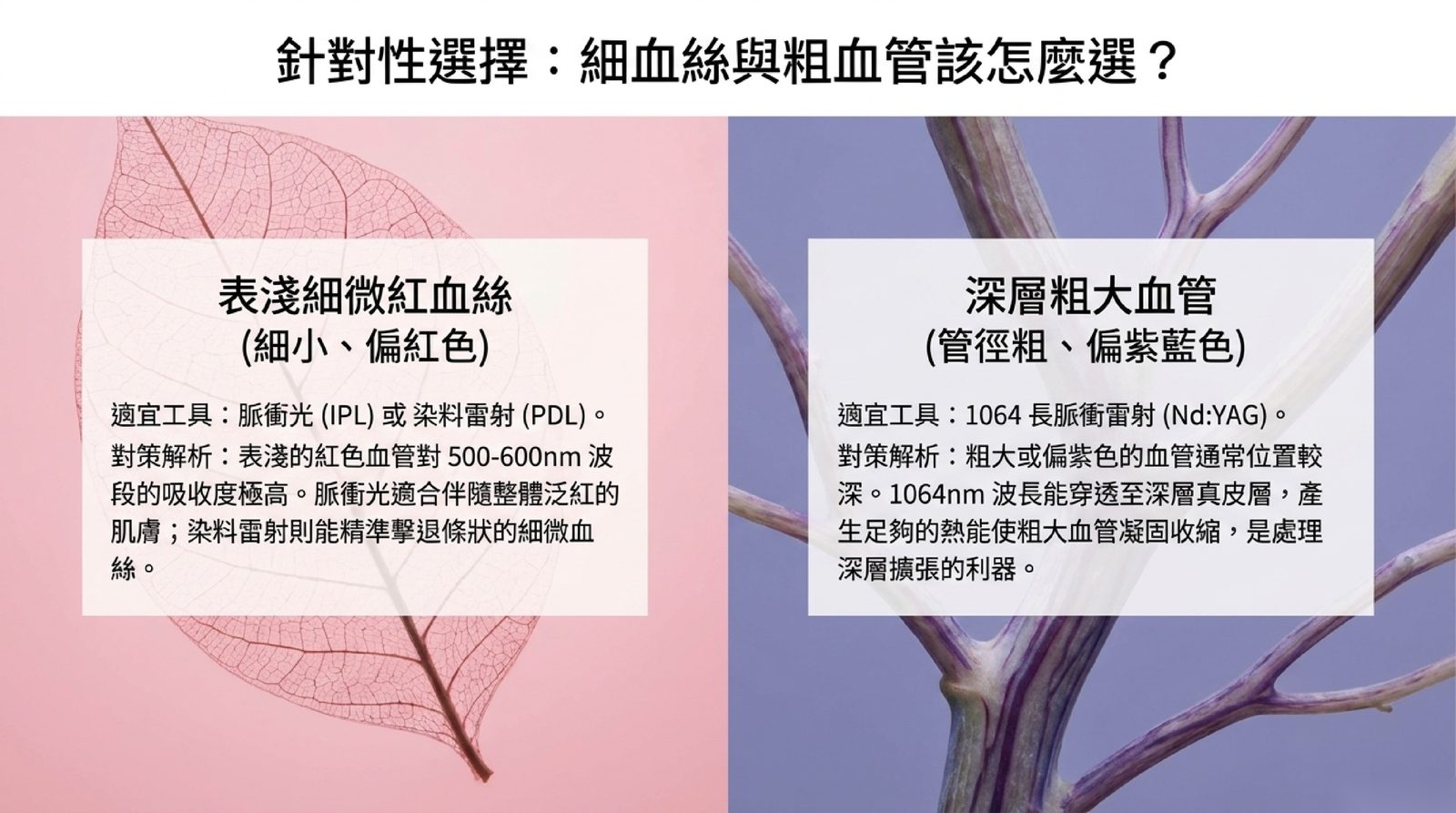 細血絲與粗血管怎麼選:表淺細微、偏紅色的血絲適合脈衝光或染料雷射;深層粗大、偏紫藍色的血管適合 1064 長脈衝雷射