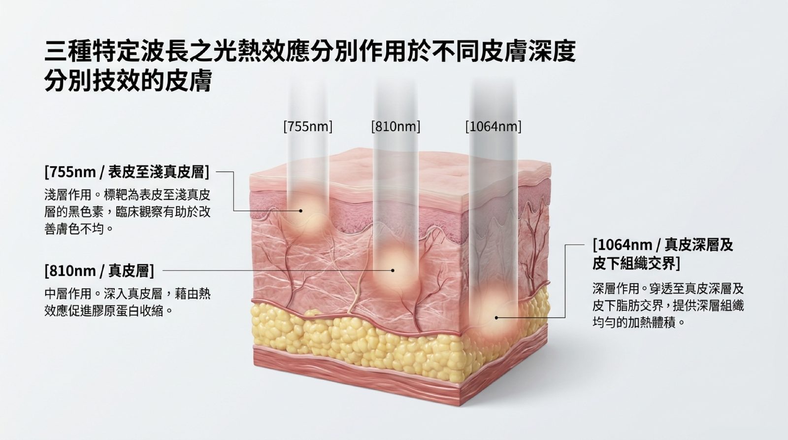 755nm、810nm、1064nm 三個波長在皮膚中的作用深度與吸收標靶示意