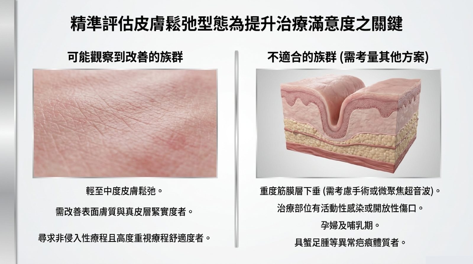 鈦提升適合與不適合的族群:輕至中度皮膚鬆弛適合,重度筋膜層下垂需考慮手術或微聚焦超音波