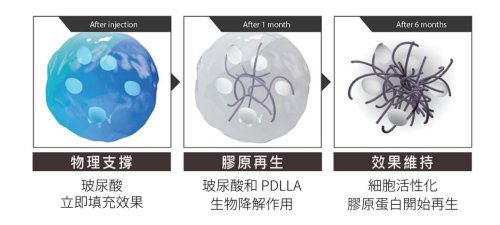 凹痘疤還有救?薇貝拉填補