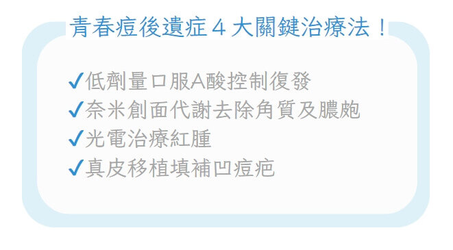 青春痘治療方法示意圖
