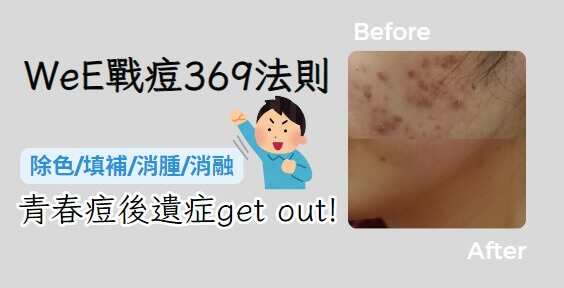 青青春戰痘機