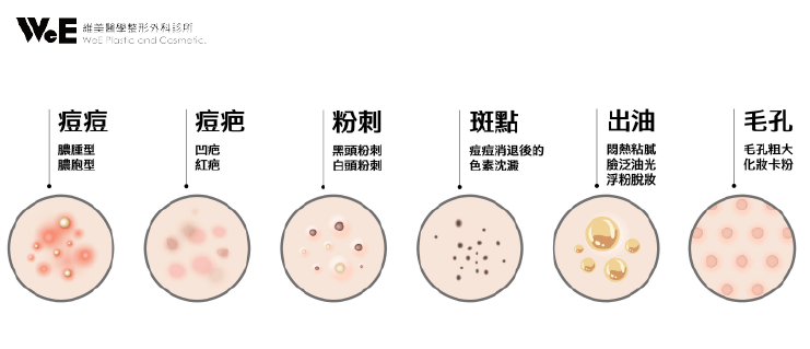 CAPRI藍雷射-常見肌膚問題類型
