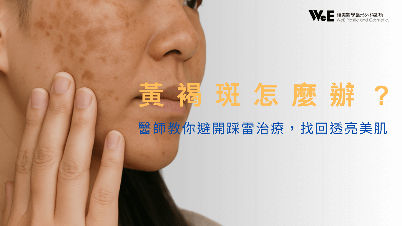 黃褐斑怎麼辦？醫師教你避開踩雷治療，找回透亮美肌